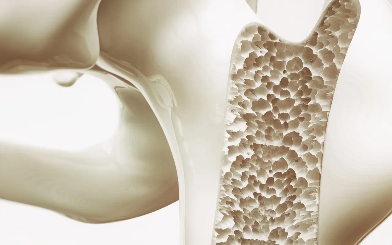 Sufres de osteoporosis: el tratamiento que realmente detiene la pérdida de calcio
